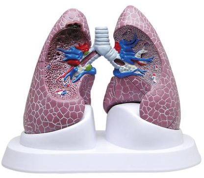 Diseased Lung